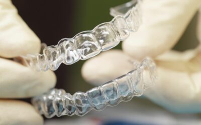 Exploring Clear Aligners as an Alternative to Metal Braces