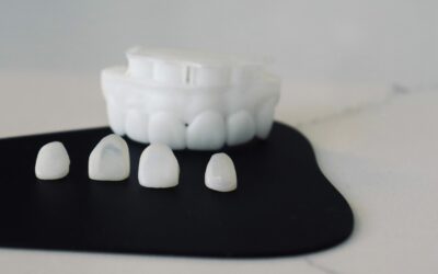 Veneers vs. Crowns: Which Solution is Right for You?